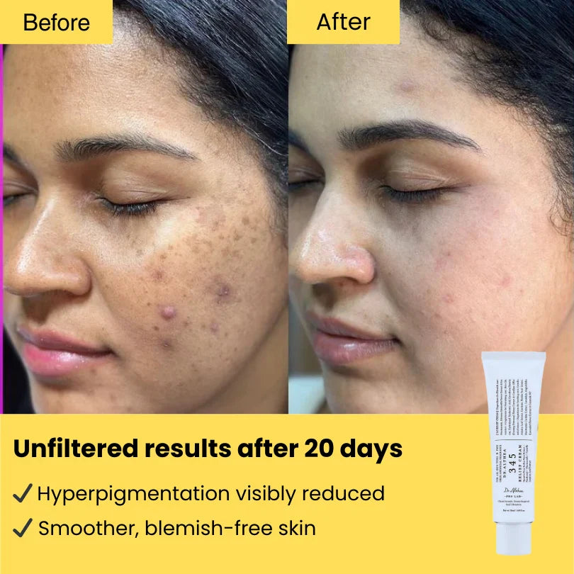 Original Dr. Althea 345 Relief Cream (50ml) - Korean Skin Barrier Repair & Acne Soothing Moisturizer