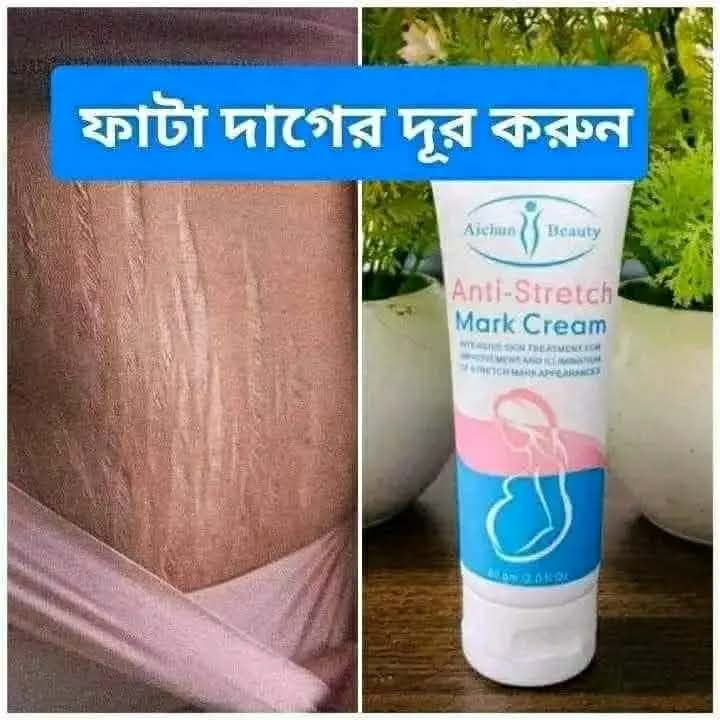Aichun Beauty Anti-Stretch Mark Cream (60g) - Intensive Treatment for Pregnancy Marks, Scars & Cellulite