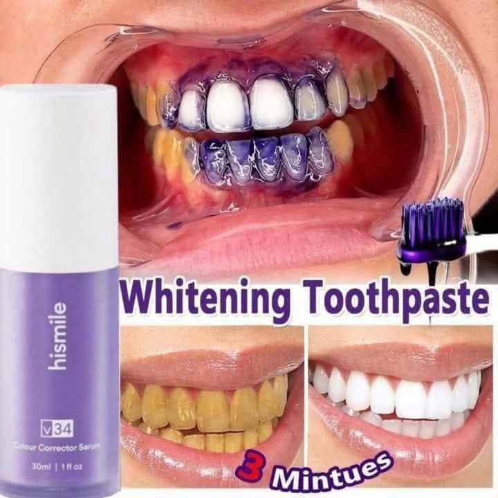 Hismile V34 Colour Corrector Serum (30ml) - Instant Teeth Whitening & Yellow Neutralizer (Peroxide-Free)