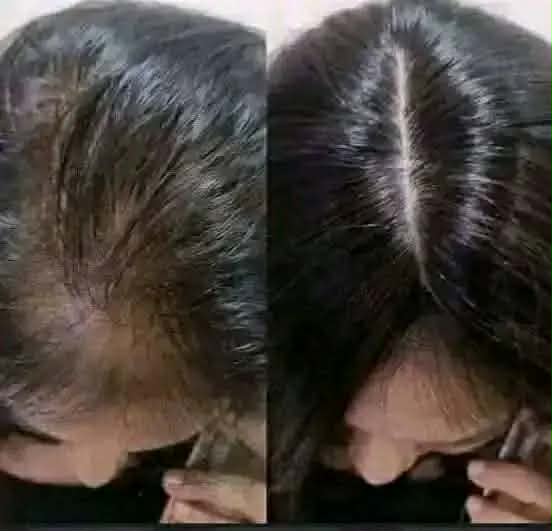 Original Zafran Hair Growth Therapy (150ml) - Intense Hair Regain Spray for Faster Growth, Hair Fall Control & Scalp Nutrition